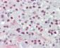 TCEAL3+5+6 Antibody (aa141-190)